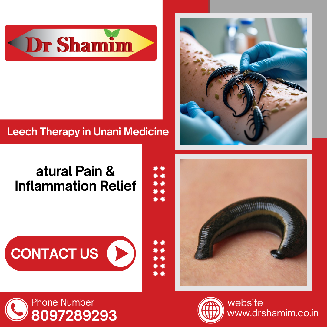 Leech Therapy in Unani Medicine – Natural Pain & Inflammation Relief