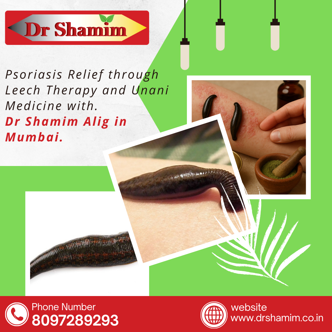  Psoriasis Relief through Leech Therapy and Unani Medicine with Dr Shamim Alig in Mumbai