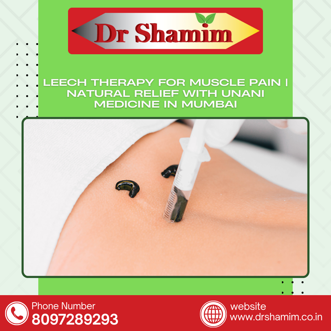  Leech Therapy for Muscle Pain | Natural Relief with Unani Medicine in Mumbai