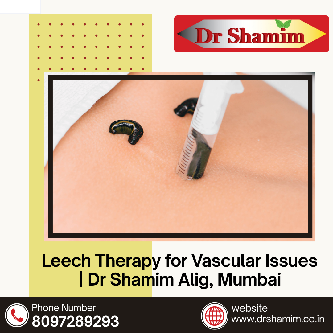 Leech Therapy for Vascular Issues | Dr Shamim Alig, Mumbai